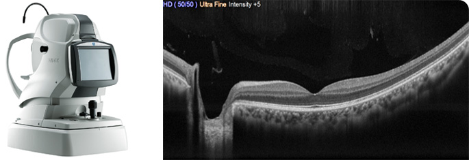 Optical Coherence Tomographer