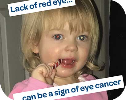 Children’s Eye Cancer – Retinoblastoma awareness week