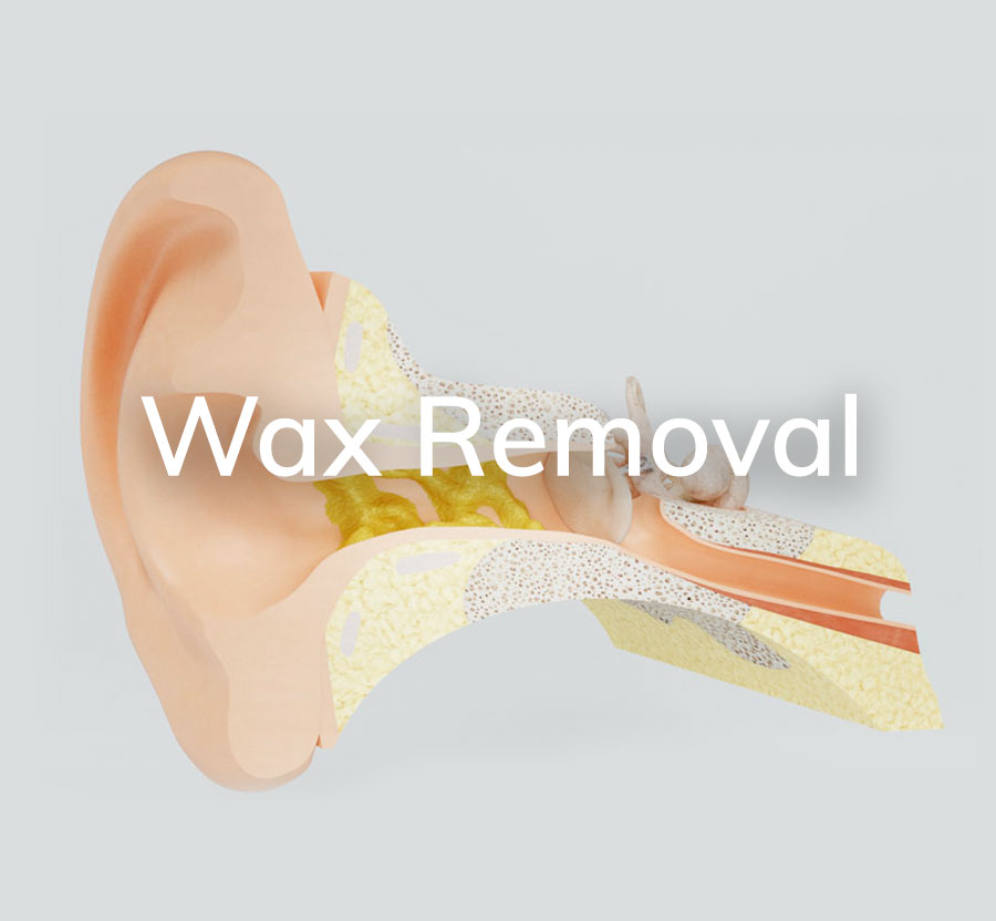 Wax Removal