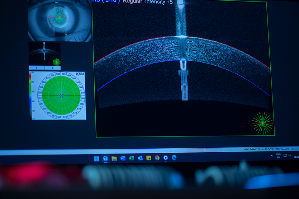 An OCT scan of an eye