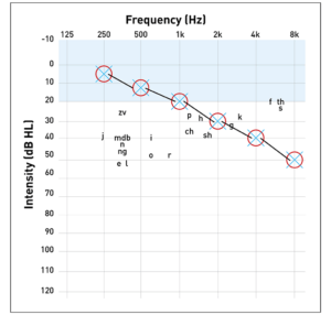 Audiogram